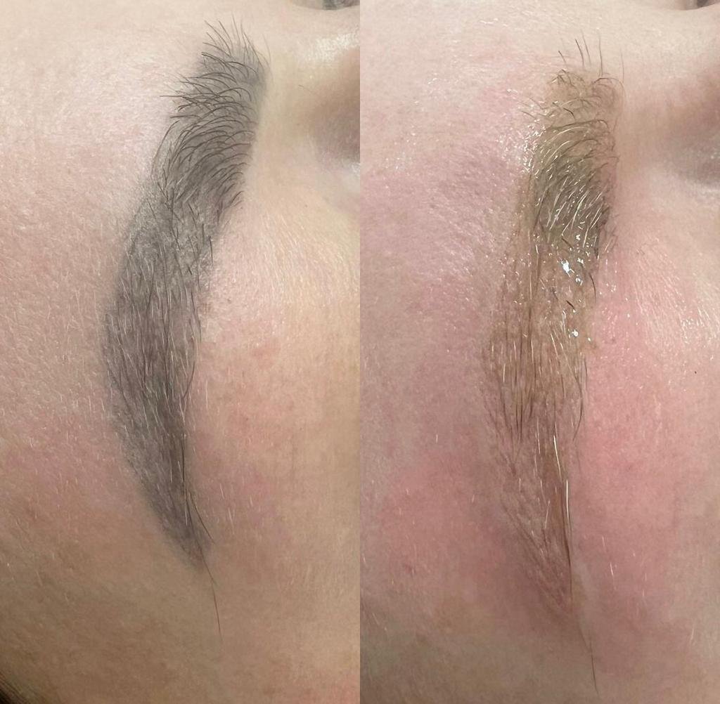Microblading Correction removal in Derbyshire