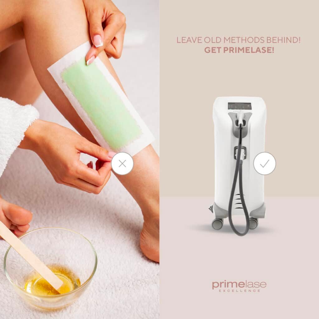 Primelase Hair Removal, Worlds Strongest machine Diode, Laser hair removal Nottingham