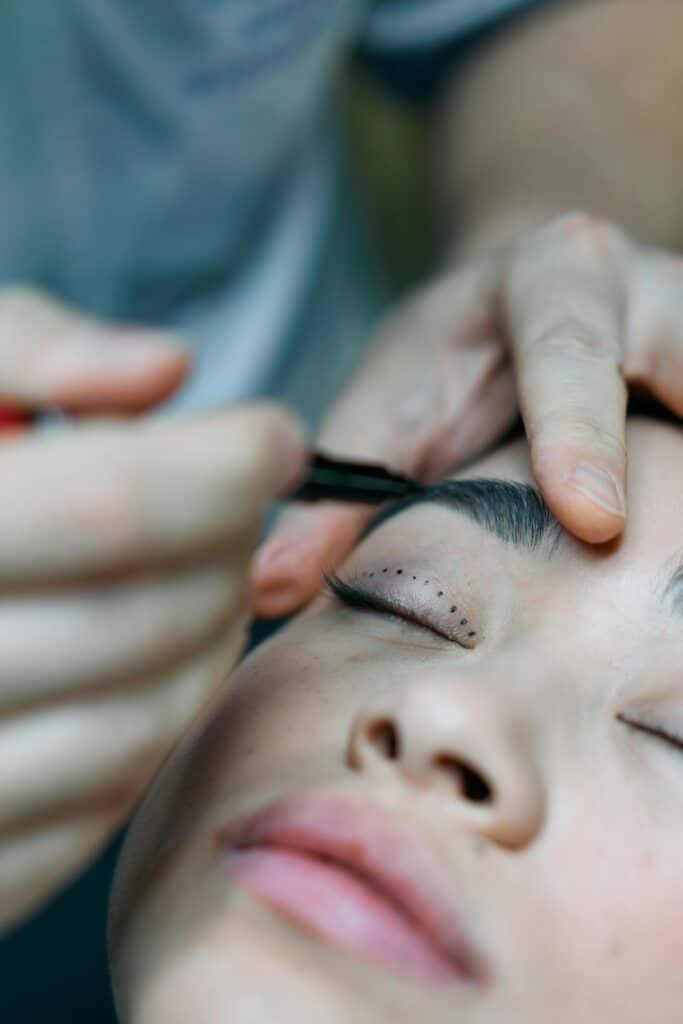 Laser Blepharoplasty