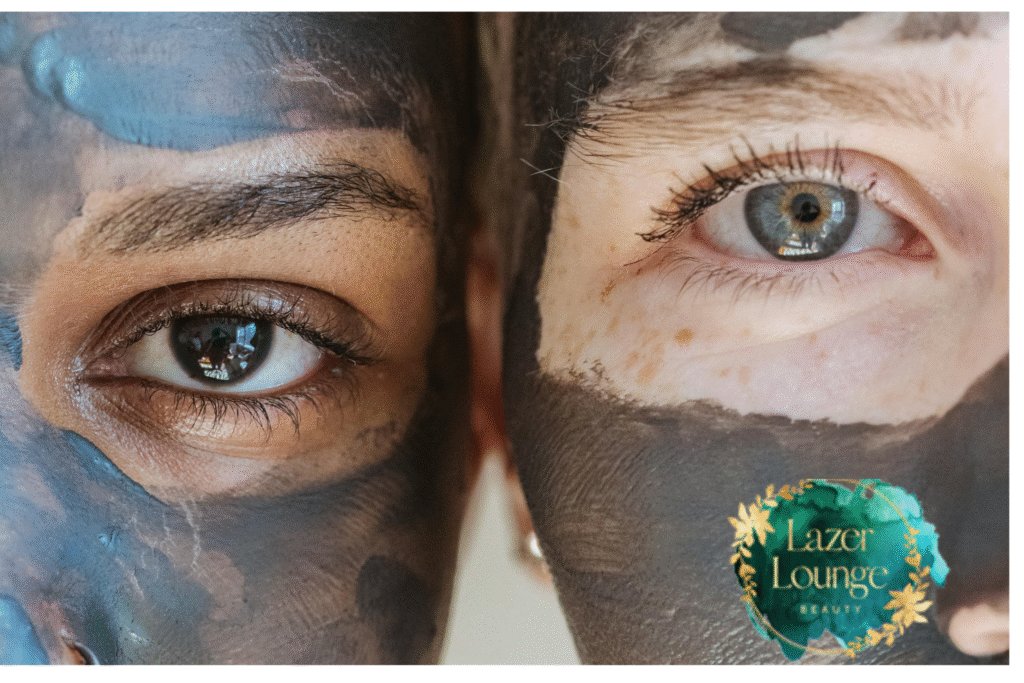 Laser Carbon Facial