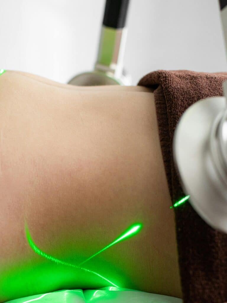 laser spine surgery