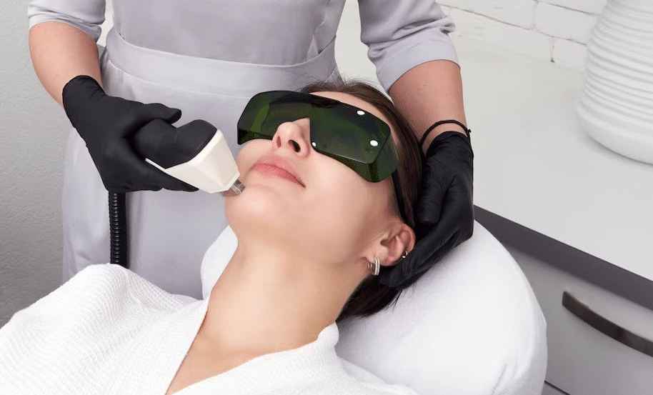 Laser Treatment at Lazer Lounge Derbyshire