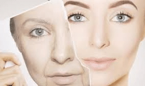 anti-aging treatments