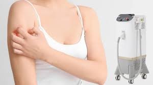 laser treatment sensitive skin