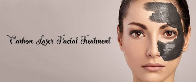 Carbon Facial with Laser Therapy in Derbyshire