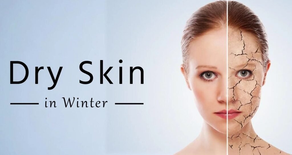 Winter Dry Skin Care