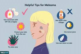 Skin Care for Melasma