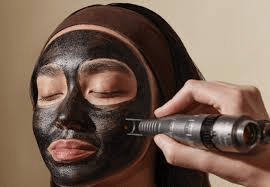 Lazer Lounge Carbon Facial Treatment