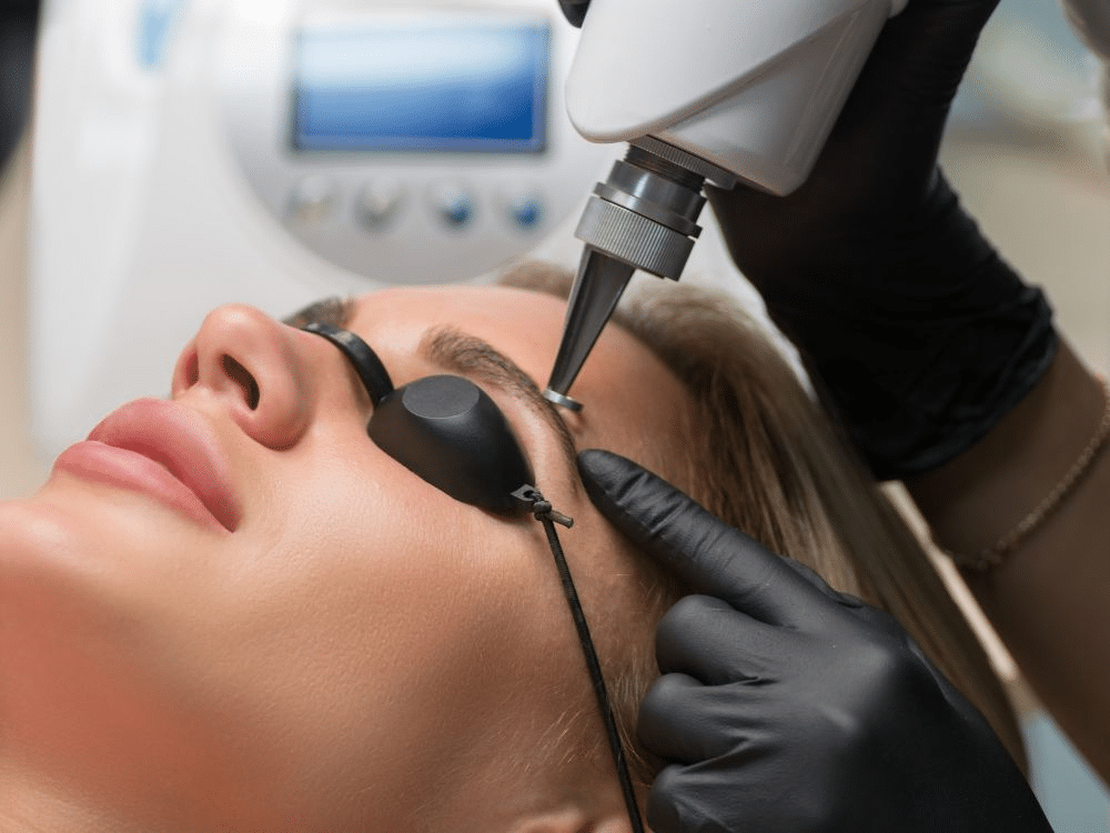 Eyebrow Laser Hair Removal Treatment "Lazer Lounge"