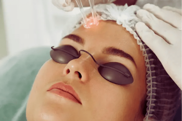 Consultation For Laser Facial Skin