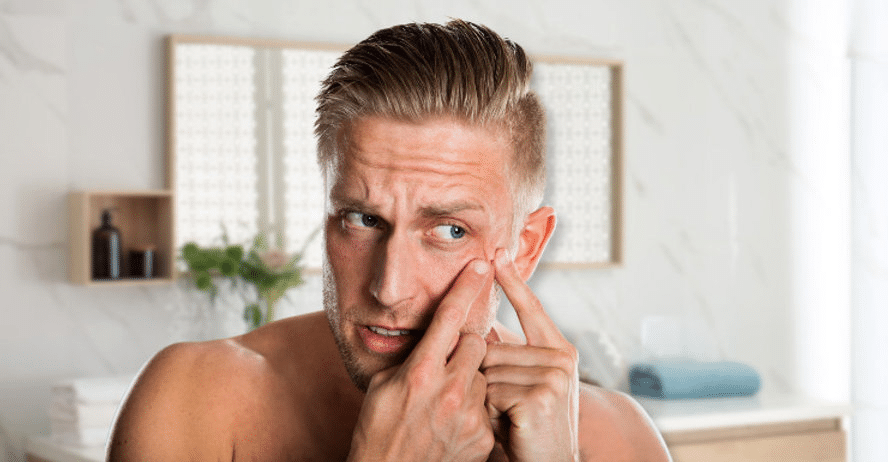 Top 6 Skin Concerns Men Face